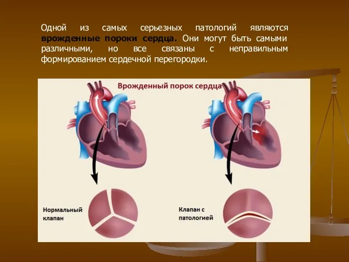 Одной из самых серьезных патологий являются врожденные пороки сердца. Они могут быть