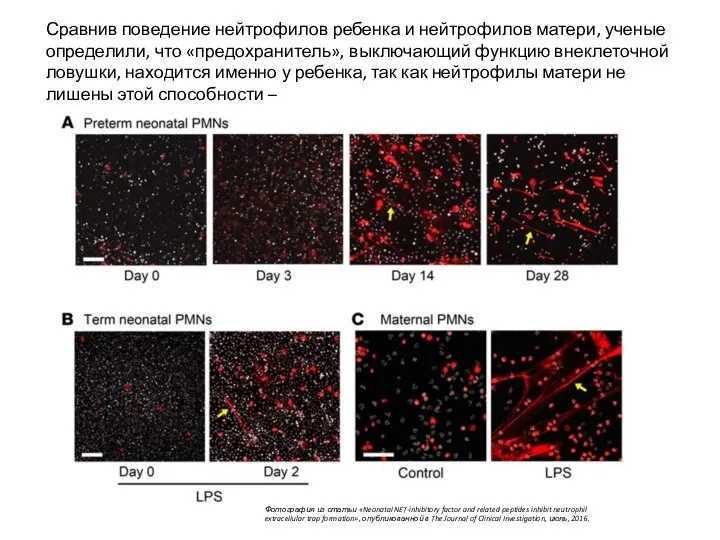 Сравнив поведение нейтрофилов ребенка и нейтрофилов матери, ученые определили, что «предохранитель», выключающий