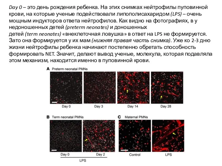 Day 0 – это день рождения ребенка. На этих снимках нейтрофилы пуповинной