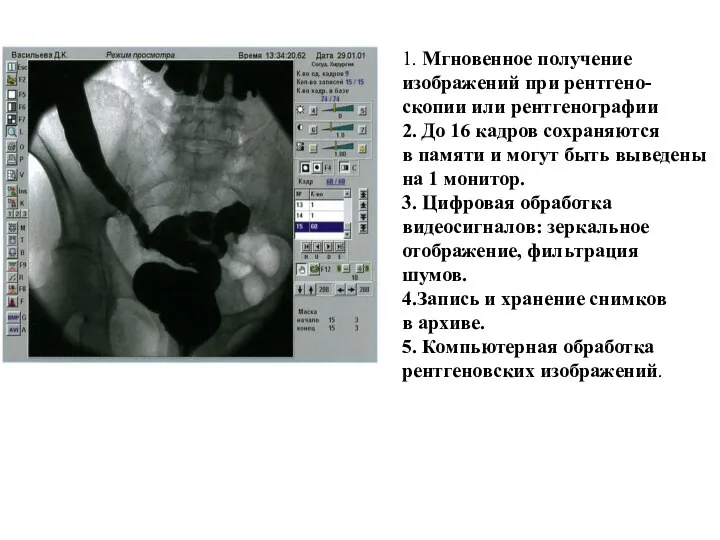 1. Мгновенное получение изображений при рентгено- скопии или рентгенографии 2. До 16
