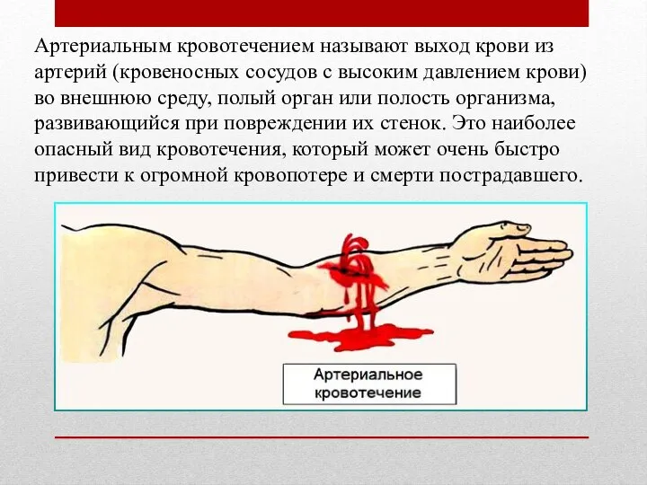 Артериальным кровотечением называют выход крови из артерий (кровеносных сосудов с высоким давлением