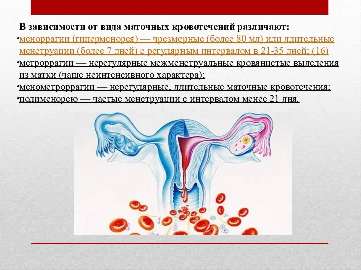 В зависимости от вида маточных кровотечений различают: меноррагии (гиперменорея) — чрезмерные (более