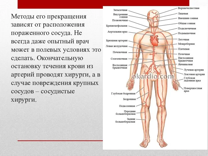 Методы его прекращения зависят от расположения пораженного сосуда. Не всегда даже опытный