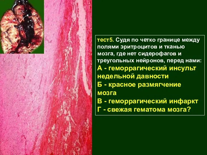 тест5. Судя по четко границе между полями эритроцитов и тканью мозга, где