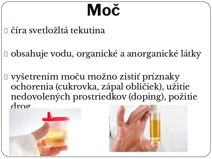 Moč číra svetložltá tekutina obsahuje vodu, organické a anorganické látky vyšetrením moču