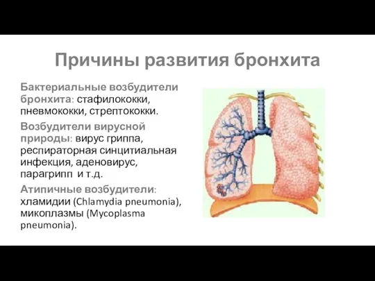 Причины развития бронхита Бактериальные возбудители бронхита: стафилококки, пневмококки, стрептококки. Возбудители вирусной природы: