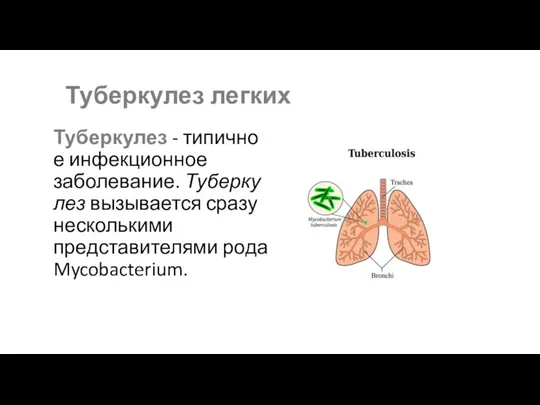Туберкулез легких Туберкулез - типичное инфекционное заболевание. Туберкулез вызывается сразу несколькими представителями рода Mycobacterium.