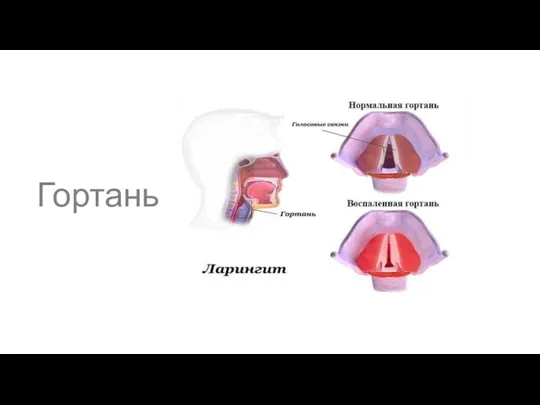 Гортань