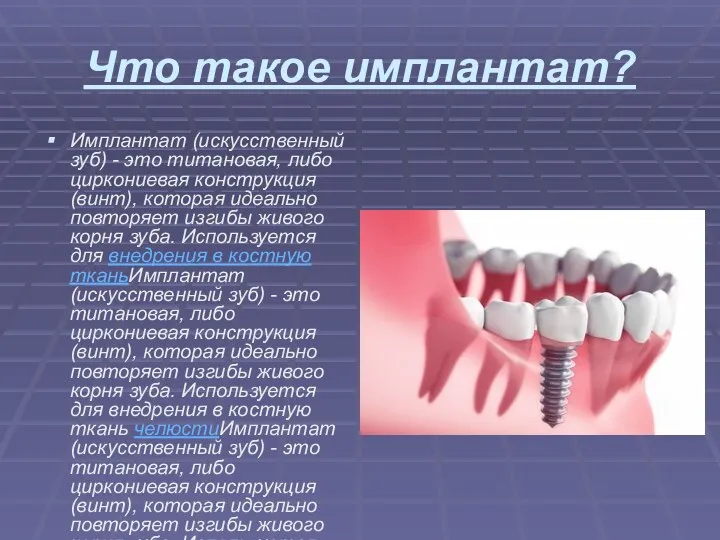 Что такое имплантат? Имплантат (искусственный зуб) - это титановая, либо циркониевая конструкция