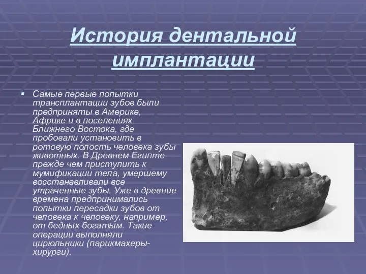 История дентальной имплантации Самые первые попытки трансплантации зубов были предприняты в Америке,