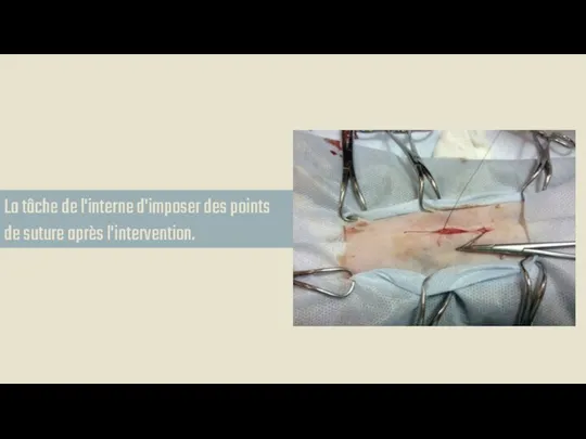 La tâche de l'interne d'imposer des points de suture après l'intervention.