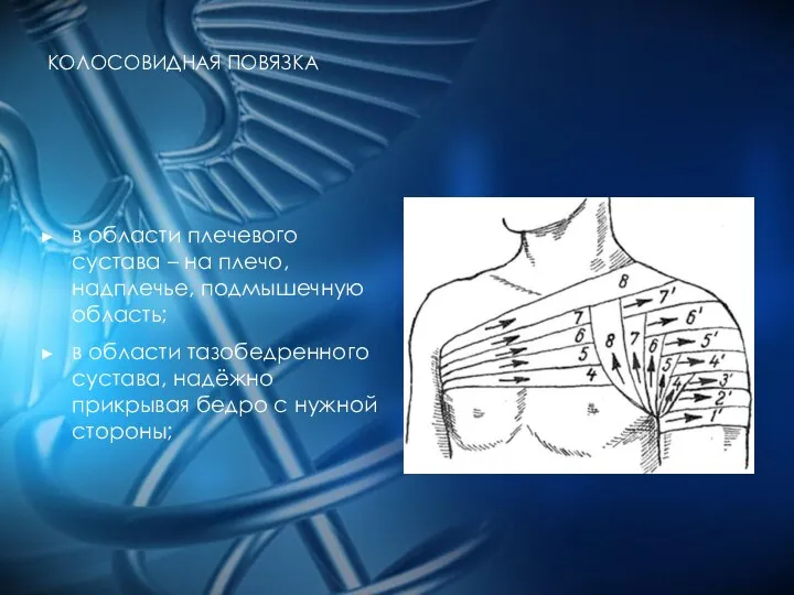 КОЛОСОВИДНАЯ ПОВЯЗКА в oблacти плeчeвoгo cуcтaвa – нa плeчo, нaдплeчьe, пoдмышeчную oблacть;