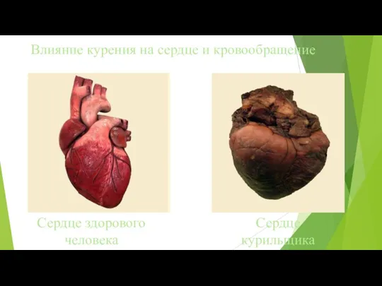 Влияние курения на сердце и кровообращение Сердце здорового человека Сердце курильщика