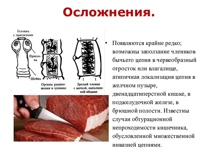 Осложнения. Появляются крайне редко; возможны заползание члеников бычьего цепня в червеобразный отросток