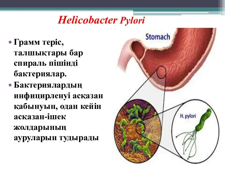 Грамм теріс, талшықтары бар спираль пішінді бактериялар. Бактериялардың инфицирленуі асқазан қабынуын, одан