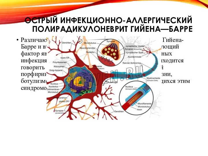 ОСТРЫЙ ИНФЕКЦИОННО-АЛЛЕРГИЧЕСКИЙ ПОЛИРАДИКУЛОНЕВРИТ ГИЙЕНА—БАРРЕ Различают первичный острый полирадикулоневрит Гийена-Барре и вторичные формы,