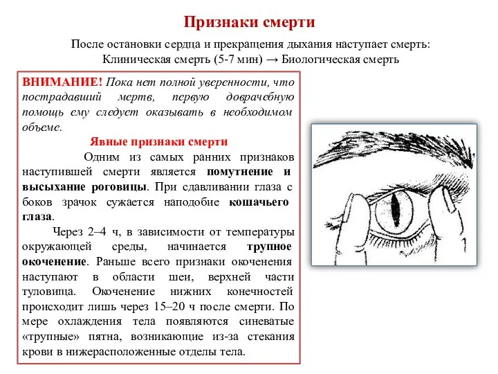 Признаки смерти После остановки сердца и прекращения дыхания наступает смерть: Клиническая смерть