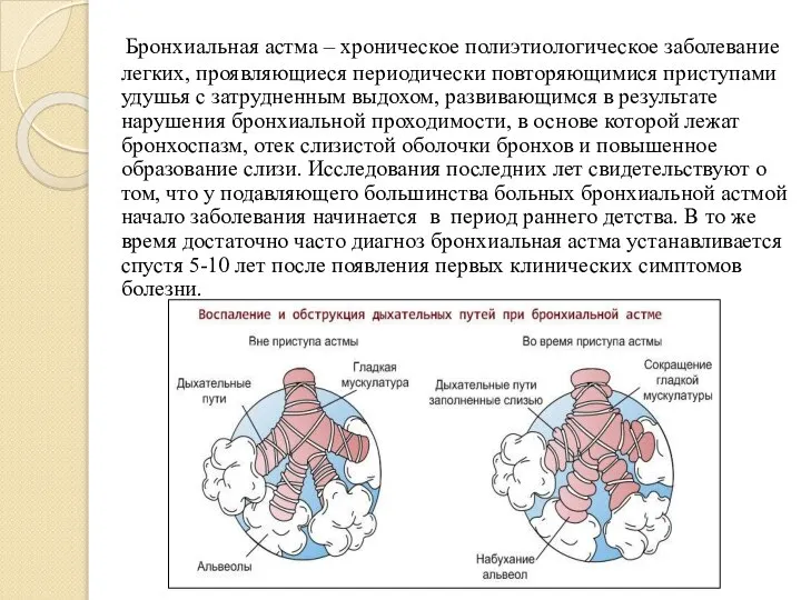 Бронхиальная астма – хроническое полиэтиологическое заболевание легких, проявляющиеся периодически повторяющимися приступами удушья