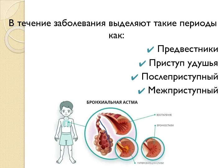 В течение заболевания выделяют такие периоды как: Предвестники Приступ удушья Послеприступный Межприступный