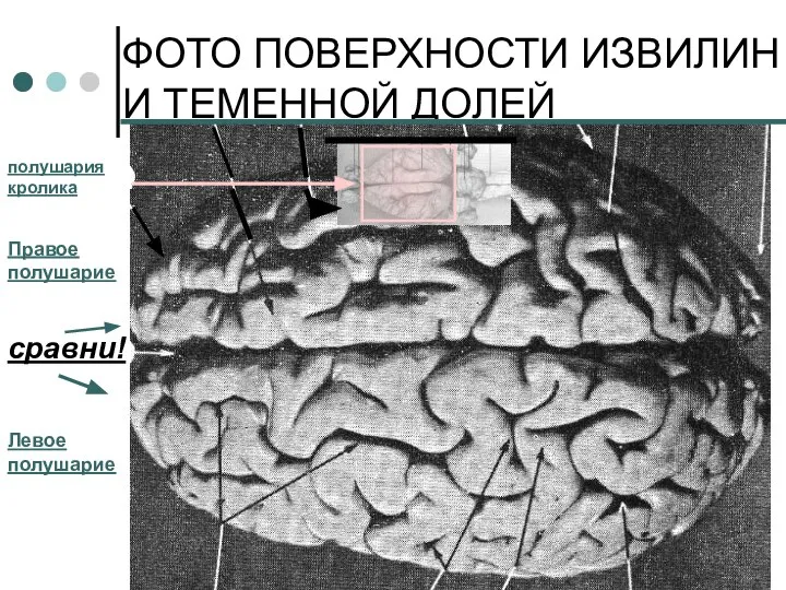 ФОТО ПОВЕРХНОСТИ ИЗВИЛИН ЛОБНОЙ И ТЕМЕННОЙ ДОЛЕЙ сравни! Левое полушарие Правое полушарие полушария кролика