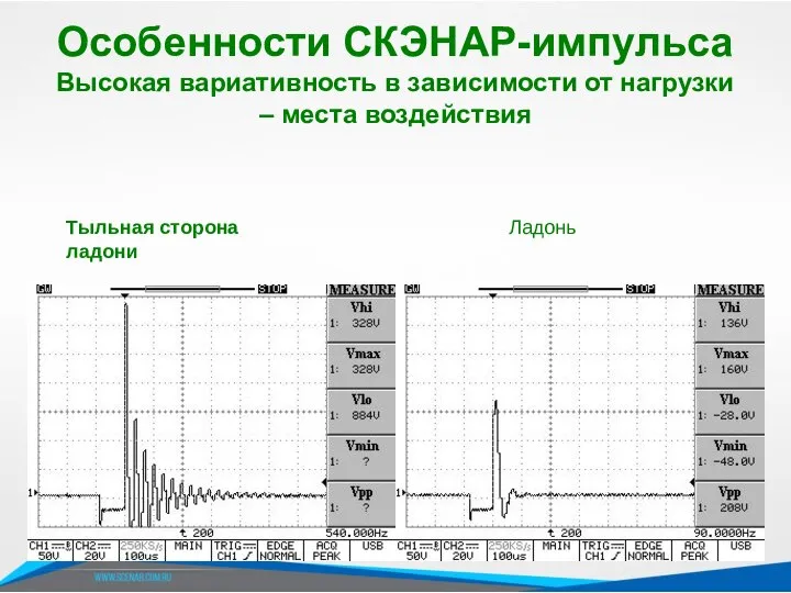 Тыльная сторона ладони Ладонь Особенности СКЭНАР-импульса Высокая вариативность в зависимости от нагрузки – места воздействия