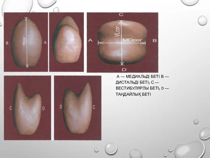А — МЕДИАЛЬДІ БЕТІ В — ДИСТАЛЬДІ БЕТІ; С — ВЕСТИБУЛЯРЛЫ БЕТІ; D — ТАҢДАЙЛЫҚ БЕТІ