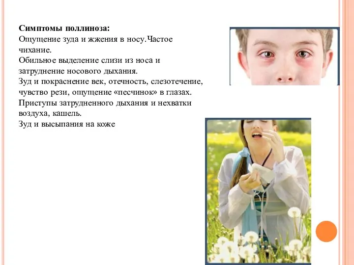 Симптомы поллиноза: Ощущение зуда и жжения в носу.Частое чихание. Обильное выделение слизи