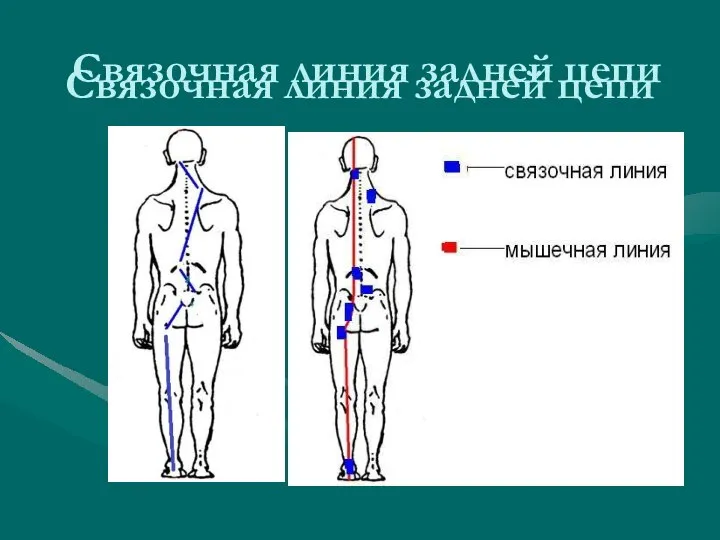 Связочная линия задней цепи Связочная линия задней цепи