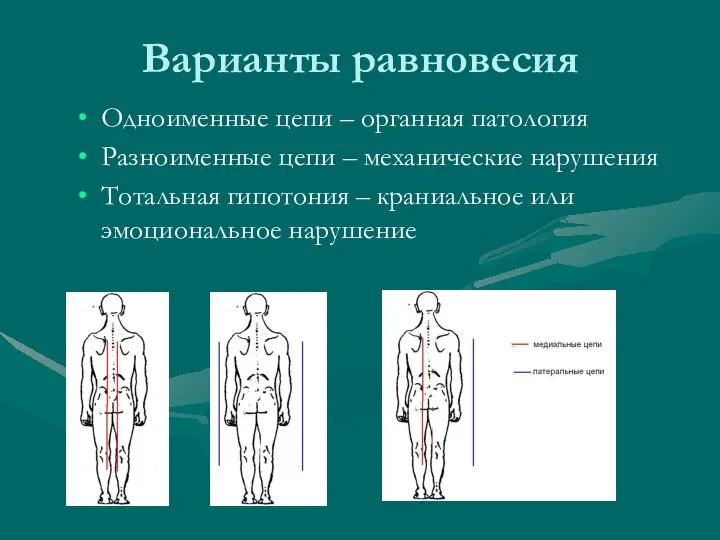 Варианты равновесия Одноименные цепи – органная патология Разноименные цепи – механические нарушения