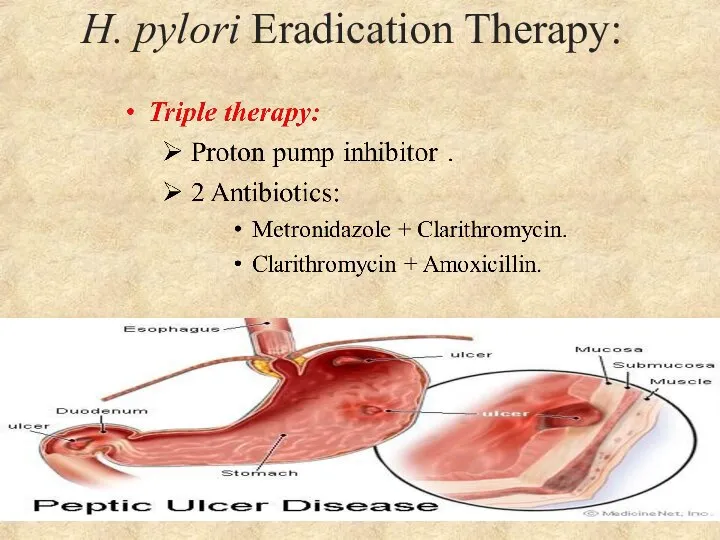 H. pylori Eradication Therapy: