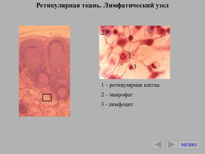 Ретикулярная ткань. Лимфатический узел 1 – ретикулярная клетка 2 – макрофаг 3