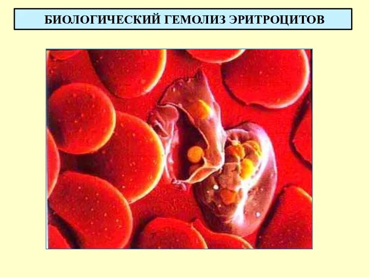 БИОЛОГИЧЕСКИЙ ГЕМОЛИЗ ЭРИТРОЦИТОВ