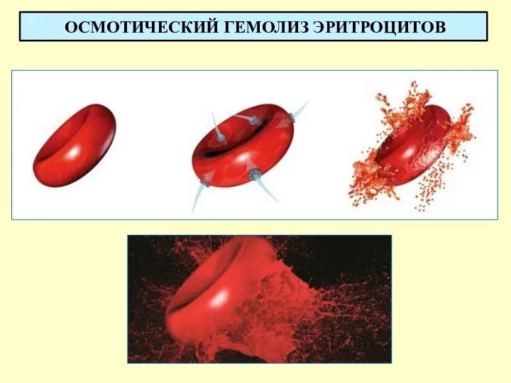 ОСМОТИЧЕСКИЙ ГЕМОЛИЗ ЭРИТРОЦИТОВ