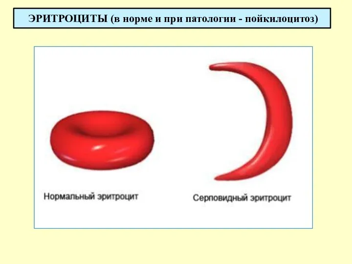 ЭРИТРОЦИТЫ (в норме и при патологии - пойкилоцитоз)