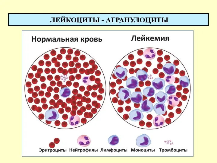 ЛЕЙКОЦИТЫ - АГРАНУЛОЦИТЫ