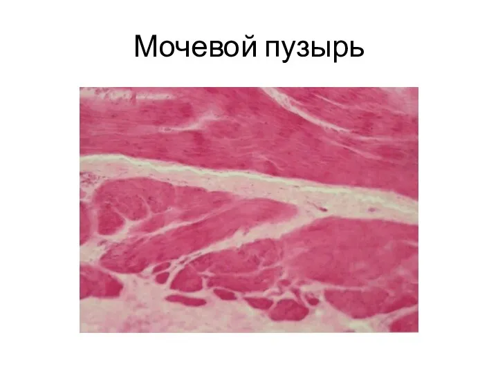 Мочевой пузырь