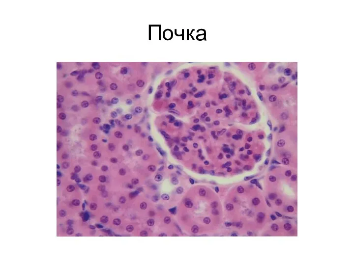 Почка