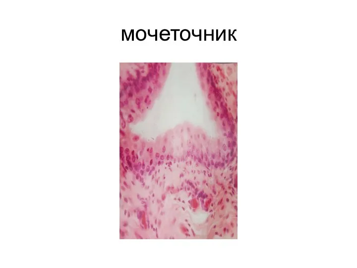 мочеточник