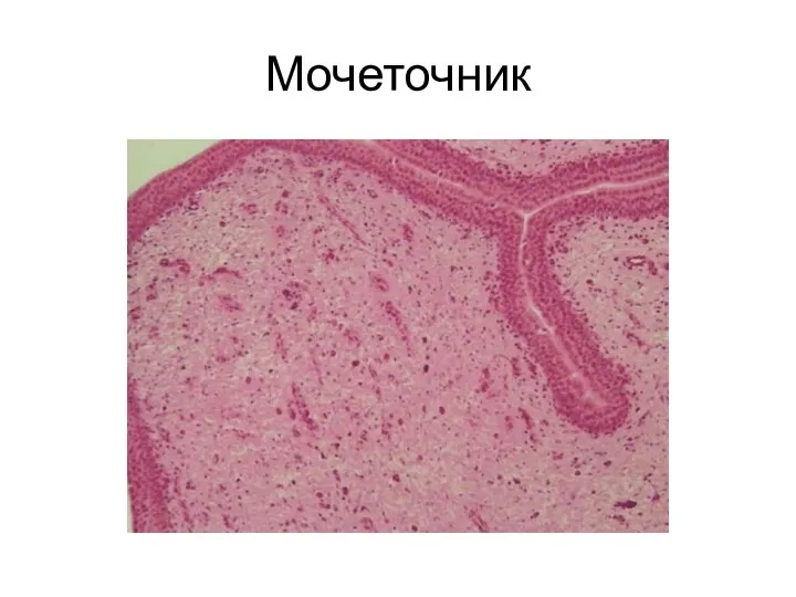 Мочеточник