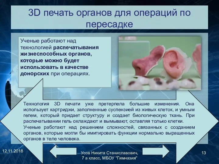 3D печать органов для операций по пересадке 12.11.2018 Усов Никита Станиславович, 7