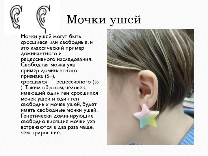 Мочки ушей Мочки ушей могут быть сросшиеся или свободные, и это классический