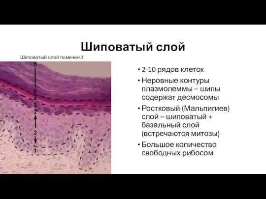 Шиповатый слой 2-10 рядов клеток Неровные контуры плазмолеммы – шипы содержат десмосомы