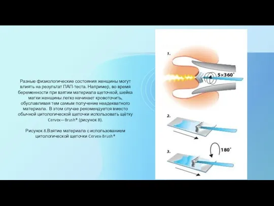 Разные физиологические состояния женщины могут влиять на результат ПАП-теста. Например, во время