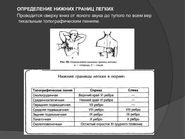 ОПРЕДЕЛЕНИЕ НИЖНИХ ГРАНИЦ ЛЕГКИХ Проводится сверху вниз от ясного звука до тупого