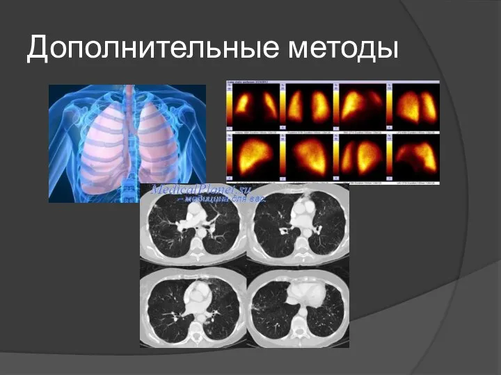 Дополнительные методы