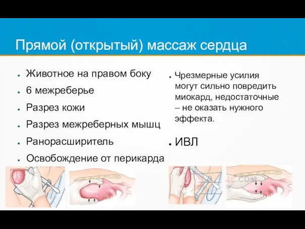 Прямой (открытый) массаж сердца Животное на правом боку 6 межреберье Разрез кожи