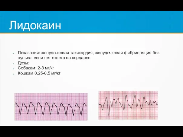 Лидокаин Показания: желудочковая тахикардия, желудочковая фибрилляция без пульса, если нет ответа на