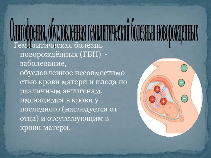 Гемолитическая болезнь новорождённых (ГБН) - заболевание, обусловленное несовместимостью крови матери и плода