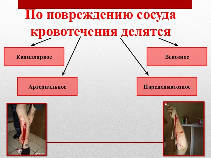 Капиллярное Артериальное Венозное Паренхиматозное