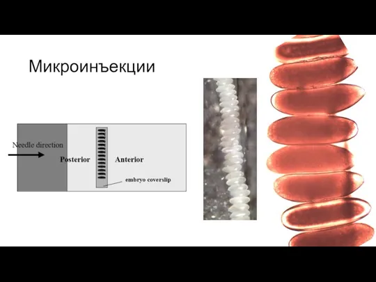 Микроинъекции